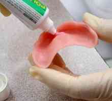Hoe om tandheelkundige kleefmiddels toe te pas