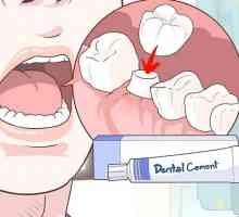Hoe om die verlies van `n tandkroon te herstel