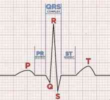 Hoe om die hartklop van `n EKG te bereken