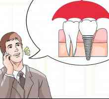 Hoe om tandheelkundige inplantings te bekostig