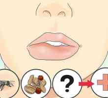 Hoe om `n geswelde lip te genees