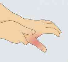 Hoe om `n gebroke duim te diagnoseer