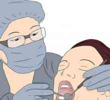 Hoe om kalm te wees voordat jy die tandheelkundige bespuiting plaas