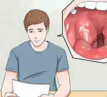 Hoe om `n strep keel te evalueer en te behandel
