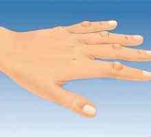 Hoe om `n velprobleem as gevolg van rumatoïede artritis te hanteer