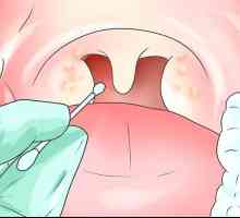 Hoe om bakteriese keelontsteking te behandel