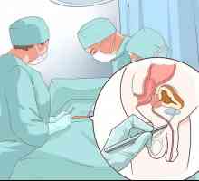 Hoe om testikulêre kanker te behandel