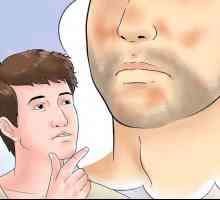 Hoe seborrheiese dermatitis op die gesig behandel word