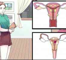 Hoe om vaginale siste te behandel
