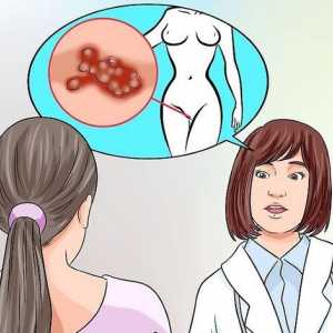 Hoe om herpes te genees