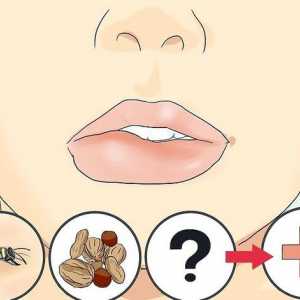 Hoe om `n geswelde lip te genees