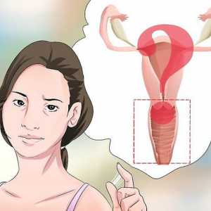 Hoe om vaginale afskeiding te diagnoseer