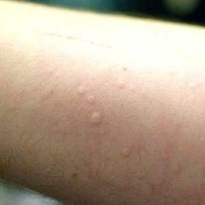 Hoe om allergieë te identifiseer