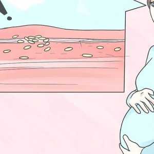 Hoe om bloedklonte te voorkom tydens swangerskap