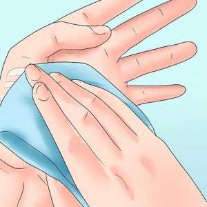 Hoe om die gom suture strips te verwyder