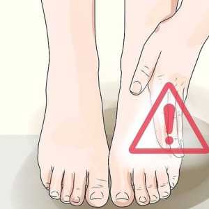 Hoe om die voete te kontroleer om te sien of hulle komplikasies van diabetes het