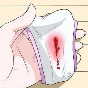 Hoe om te weet of jy swanger is as jy onreëlmatige menstruasieperiodes het